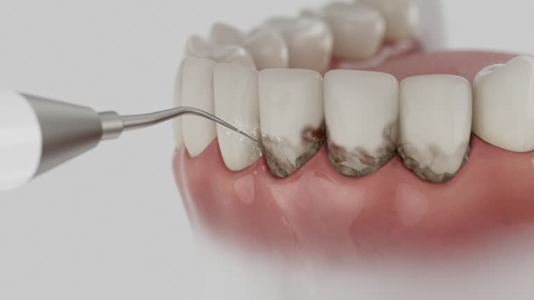 Reliable Dental contractor in Old Fig Garden, CA by Dentist Open Now